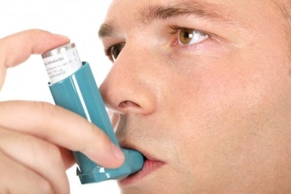 Asthma